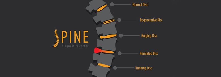 Chiropractic Jacksonville FL Herniated Disc Chiropractic Jacksonville FL Herniated Disc